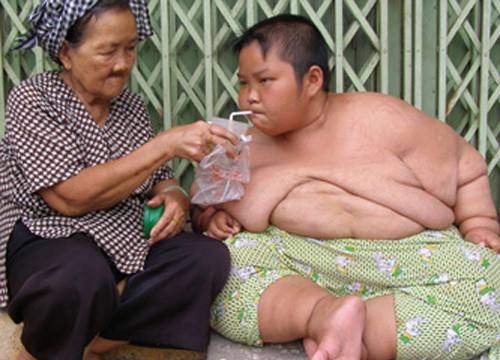 25% dân số Việt Nam đang bị thừa cân béo phì