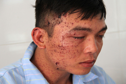Phút kinh hoàng cha ôm mìn tự sát qua lời kể của các con