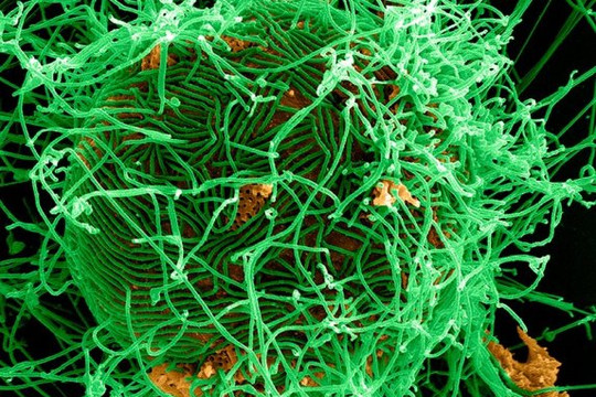 Ebola có thể lây nhiễm qua đường tình dục