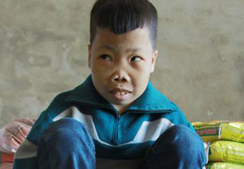 Tính mạng hơn 10 triệu người Việt bị đe doạ bởi căn bệnh "không thể chữa khỏi"
