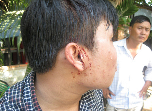 Hai phóng viên bị đánh trọng thương khi đi tác nghiệp