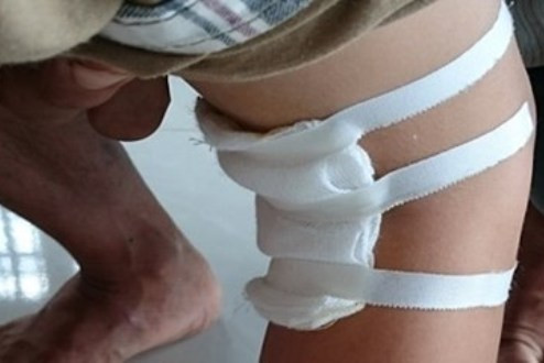 Tin sức khỏe nổi bật ngày 7/8/2015: Kỷ luật bác sĩ mổ… nhầm chân