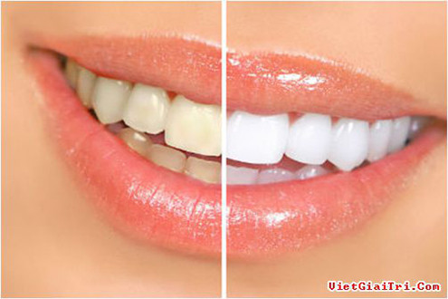 Cách chăm sóc để có bộ răng luôn trắng bóng tại nhà