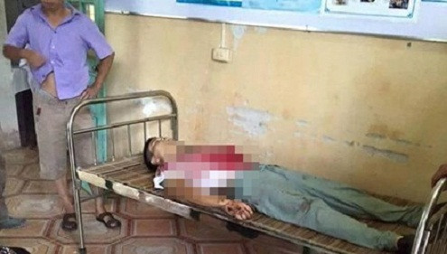 Tin tức pháp luật ngày 25/8: Thiếu nữ 18 tuổi bị đâm nhiều nhát ở Trà Vinh
