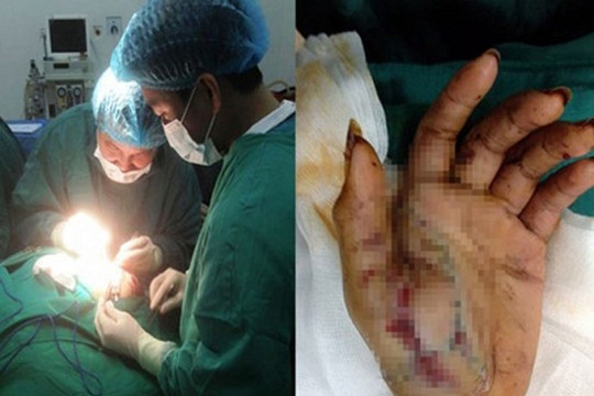 Tin tức xã hội ngày 31/1: Đốt pháo tự chế, bé 12 tuổi trọng thương