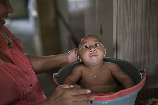 Trung Quốc xác nhận trường hợp nhiễm virus Zika đầu tiên