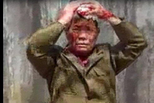 Thái Nguyên: Con dâu đánh chảy máu đầu bố chồng gây phẫn nộ