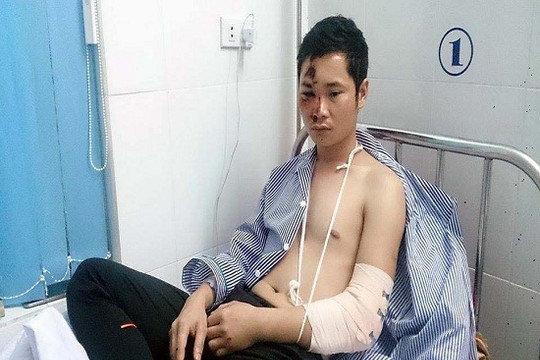 Mâu thuẫn từ việc làm ăn, một giám đốc bị đánh gãy tay
