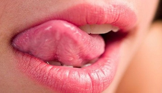 Màu sắc của lưỡi “tố cáo” bệnh gì?