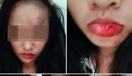 Con dâu bị bố chồng đạp vào mặt chỉ vì muốn bật điều hòa?
