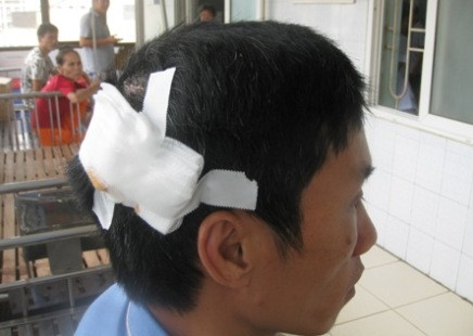 Chồng tố bị "nhân tình" của vợ đánh nứt hộp sọ