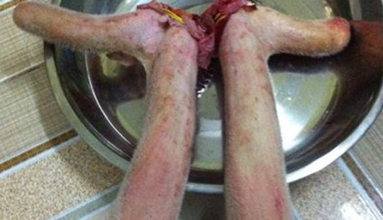 Mất chức năng đàn ông vì... nhung hươu