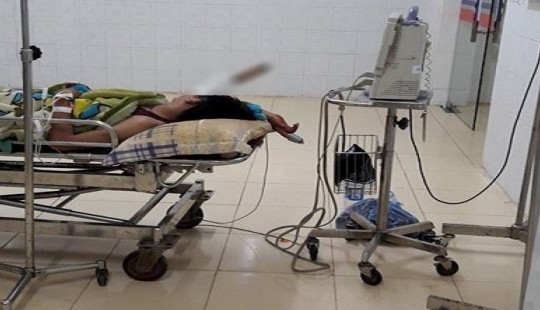 Mâu thuẫn khi ăn cơm, cầm dao đâm vào đầu đồng nghiệp