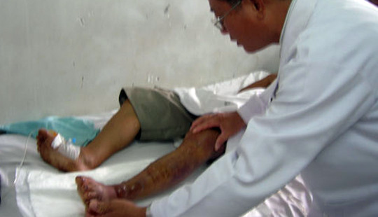 Đà Nẵng: Cứu sống bệnh nhi bị rắn độc cắn