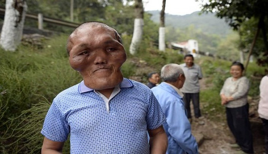 Kỳ dị ông lão có khuôn mặt của “người ngoài hành tinh”
