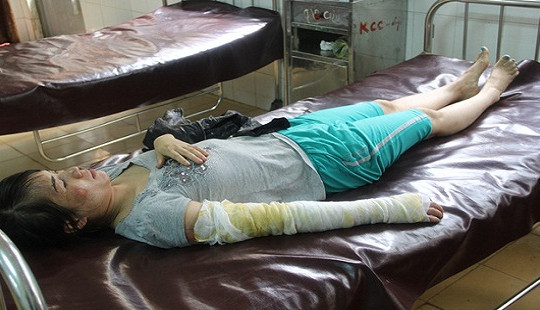 Đổ nước sôi lên đầu vợ vì... đi làm đẹp