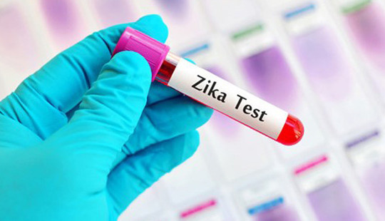 TP.HCM: Phát hiện 17 trường hợp nhiễm vi rút Zika