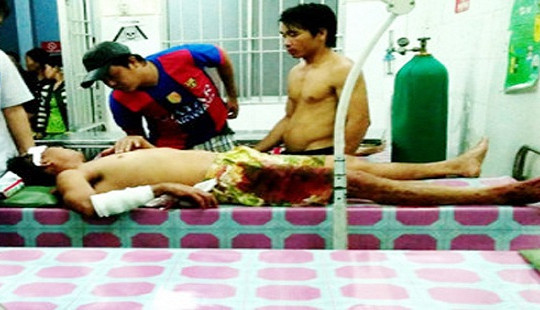 Vợ bất ngờ cầm dao chém chồng tới tấp