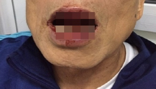 Người hành hung Tiến sĩ 76 tuổi là Phó giám đốc Trung tâm dịch vụ đối ngoại
