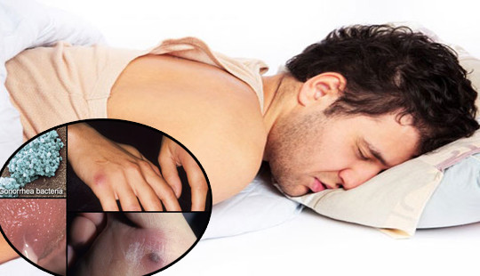 5 bệnh đáng sợ lây qua đường tình dục nam giới dễ mắc