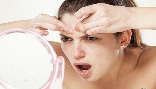 Tùy ý nặn mụn trên mặt: Hành động nhỏ, hậu quả khôn lường