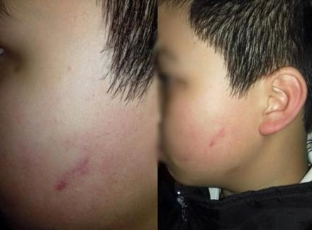 Chủ tịch UBND TP Hà Nội yêu cầu làm rõ vụ giáo viên cho cả lớp tát vào mặt học sinh