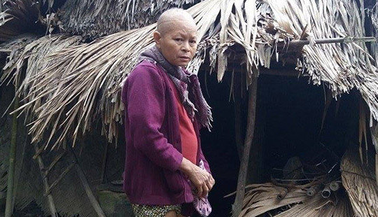 Xót lòng mẹ già 92 tuổi nuôi con gái bị bệnh tâm thần hơn 30 năm
