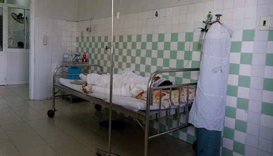 Vụ vợ xích chân tẩm xăng đốt chồng: Nghi vấn do ghen tuông