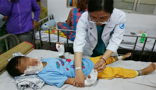 Bé trai bị điện giật phải cắt bỏ gần 10 ngón tay