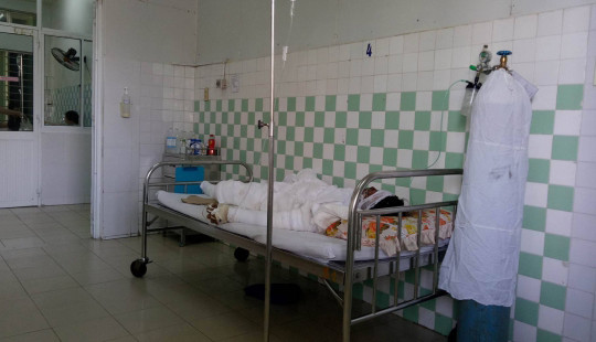 Vụ vợ xích chân đốt chồng: Người chồng đã tử vong