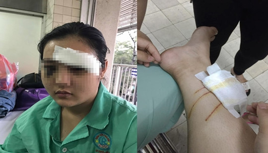 TP. HCM: Thiếu nữ bị 20 thanh niên tấn công dã man