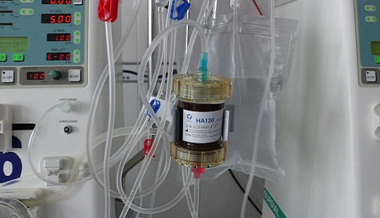 BVĐK Giá Rai tiếp nhận quả lọc hấp phụ HA130 điều trị bệnh nhân suy thận