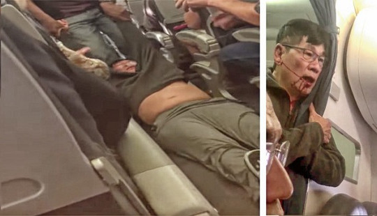 Những diễn biến mới nhất về vụ United Airlines ngược đãi bác sĩ gốc Việt