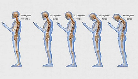 Sử dụng smartphone quá lâu gây đau mỏi vai, gáy