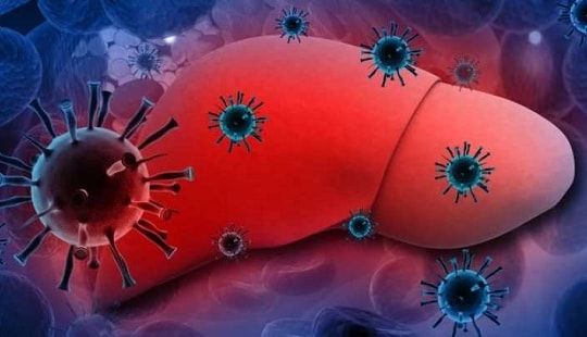 Số người chết vì bệnh gan nhiều hơn AIDS và lao