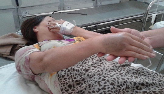 Chuyên gia chỉ ra 5 sai lầm khi sơ cứu người bị rắn độc cắn