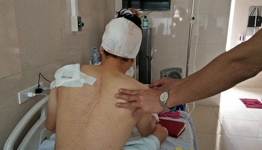 Hà Nội: Côn đồ ngang nhiên vào chung cư Mandarin Garden chém người giữa ban ngày