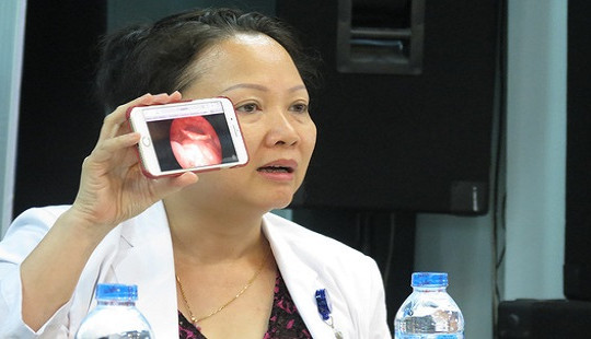 Suýt chết vì viêm thanh nhiệt cấp sau 20 ngày hóc xương cá