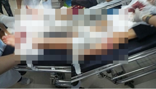 Nam Định: Côn đồ chém trọng thương nam thanh niên tại cửa hàng mỹ phẩm
