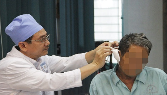 Cụ ông 73 tuổi suýt chết vì ngoáy tai bằng tăm nhang