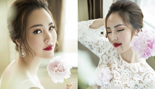 Á hậu Thụy Vân phủ nhận chuyện đẹp lên nhờ botox