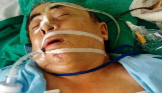 Mua nước chè không được, dùng dao truy sát cả nhà hàng xóm