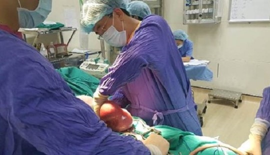 20 khối u mỡ trong bụng khiến người phụ nữ như mang bầu 8 tháng