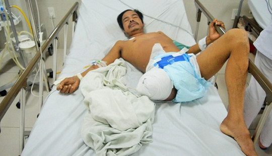 Hy hữu, người đàn ông sống sót sau 6 ngày bị rắn độc cắn