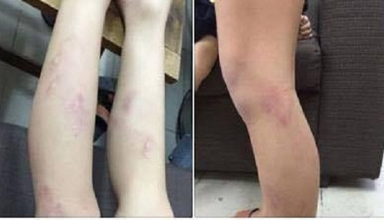 Yêu cầu làm rõ vụ 11 học sinh lớp 2 bị giáo viên bạo hành