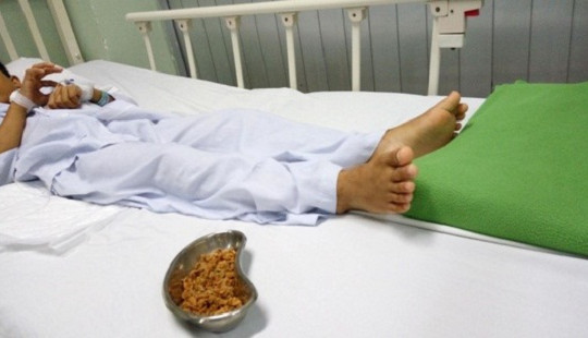 Hạt sơ ri nảy mầm trong hậu môn bé trai 11 tuổi