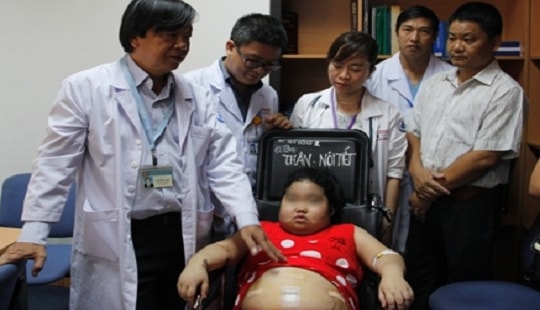 Mắc bệnh hiếm gặp khiến bé gái 11 tuổi tăng cân "vùn vụt"