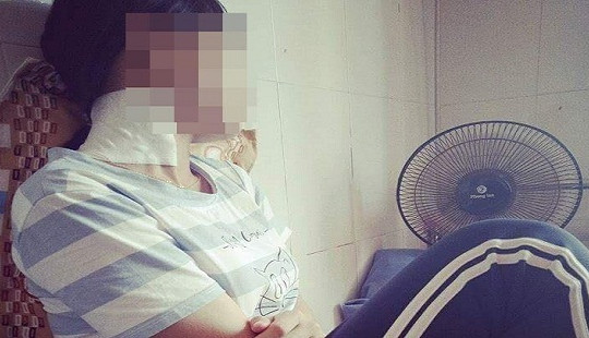 Nữ sinh lớp 12 bị nhóm bạn đánh nhập viện