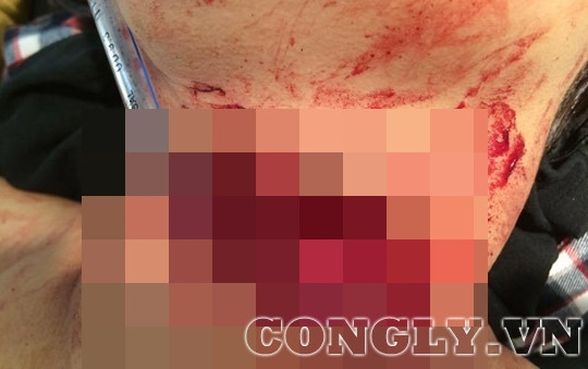 Hành vi man rợ của thiếu niên 16 tuổi cứa cổ nữ chủ quán cắt tóc