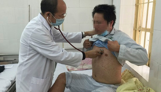 Vào "mùa" bệnh sởi, nhiều người gặp biến chứng nguy hiểm